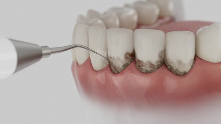 Reliable Invisalign Clear Aligners contractor in Clinton, LA by Smile Center Dentistry